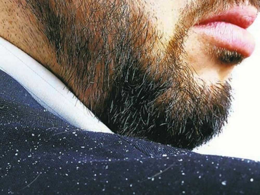 شوره ریش