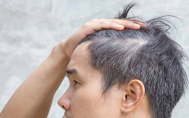 دلیل سفیدشدن زودهنگام مو