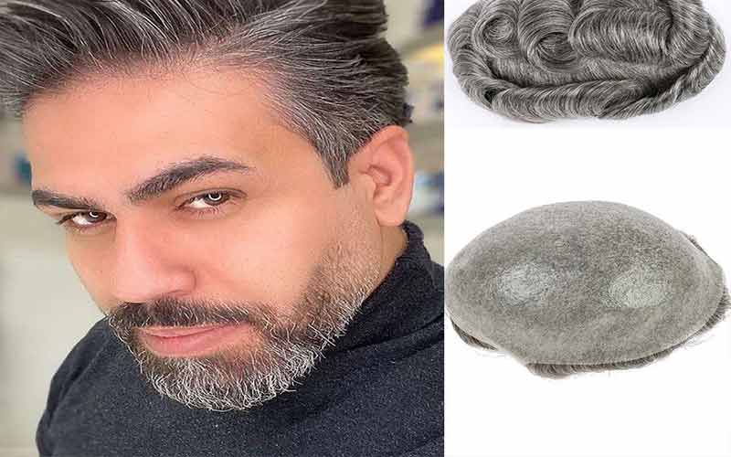 جلوگیری از خشکی پروتز مو