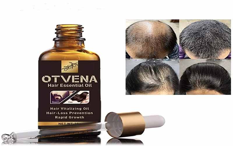 درمان ریزش مو با شامپوی گیاهی