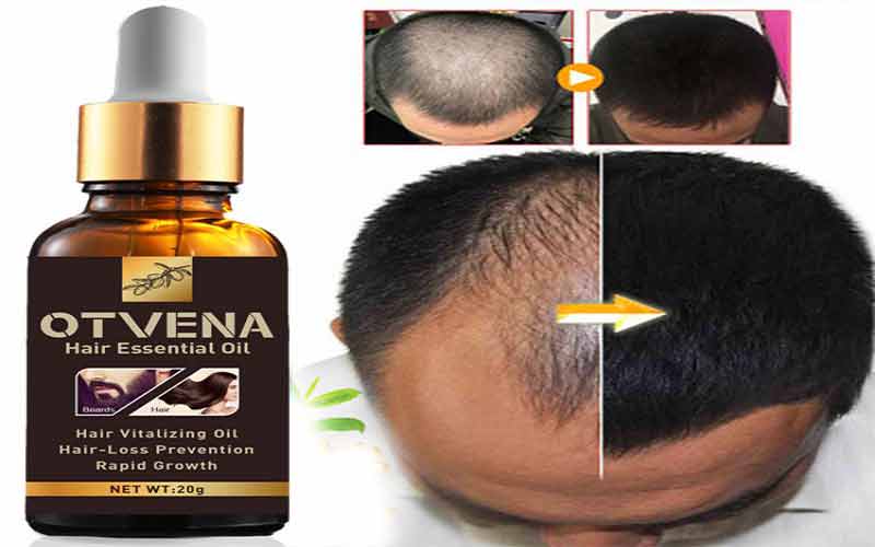 درمان ریزش مو با شامپوی گیاهی