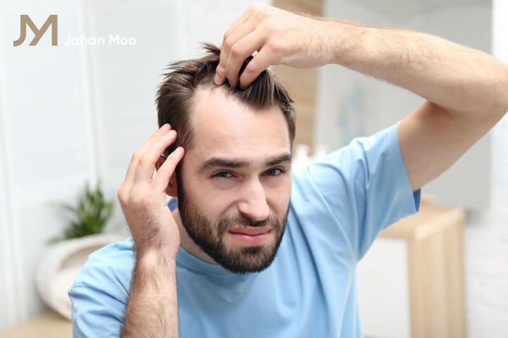کنترل ریزش مو