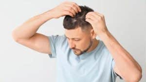 بهترین روشهای جلوگیری از ریزش مو در آقایان