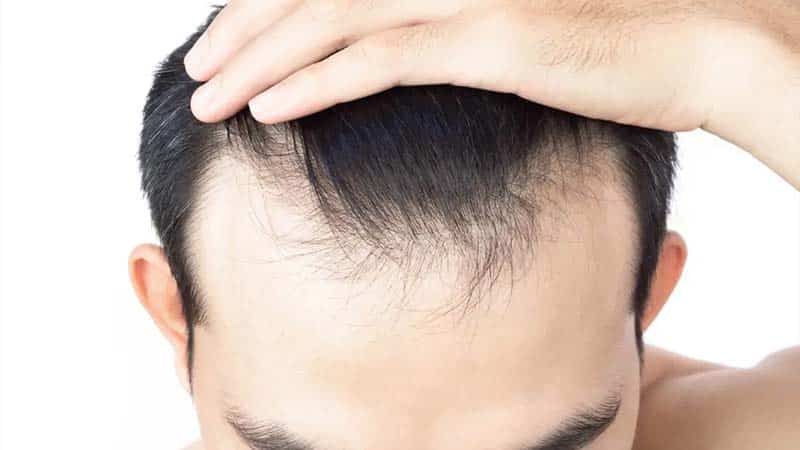 ترمیم و بازسازی مو برای جلوگیری از ریزش بیشتر
