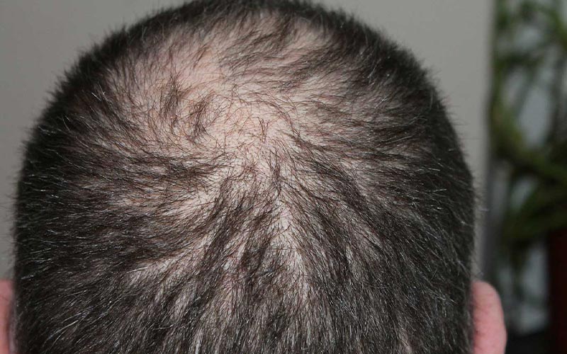 استفاده از تکنیکهای آرایشگری برای حجمدهی
